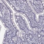 CARTPT Polyclonal Antibody