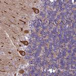 SMPD4 Polyclonal Antibody