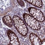 MON1B Antibody in Immunohistochemistry (Paraffin) (IHC (P))
