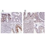 hnRNP UL1 Antibody in Immunohistochemistry (IHC)