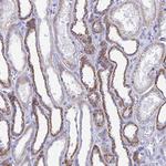 ACSM1 Polyclonal Antibody