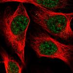 C19orf47 Polyclonal Antibody