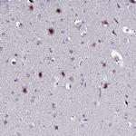 C19orf47 Antibody in Immunohistochemistry (Paraffin) (IHC (P))