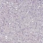 C19orf47 Antibody in Immunohistochemistry (Paraffin) (IHC (P))