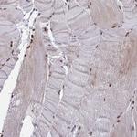 C19orf47 Antibody in Immunohistochemistry (Paraffin) (IHC (P))