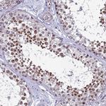 C19orf47 Antibody in Immunohistochemistry (Paraffin) (IHC (P))
