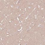 PGRP-L Antibody in Immunohistochemistry (Paraffin) (IHC (P))