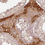 PGRP-L Antibody in Immunohistochemistry (Paraffin) (IHC (P))