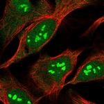 MOB2 Polyclonal Antibody