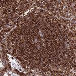 ARCH Antibody in Immunohistochemistry (Paraffin) (IHC (P))