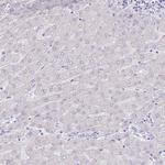 PSG11 Antibody in Immunohistochemistry (Paraffin) (IHC (P))