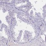 PSG11 Antibody in Immunohistochemistry (Paraffin) (IHC (P))