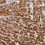 LRRC69 Antibody in Immunohistochemistry (Paraffin) (IHC (P))