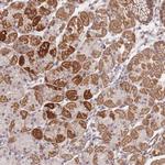 MRPS31 Antibody in Immunohistochemistry (IHC)