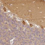 ANKRD18A Antibody in Immunohistochemistry (Paraffin) (IHC (P))