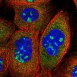 ANKRD18A Polyclonal Antibody