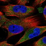 FAM160A1 Polyclonal Antibody