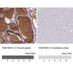 FAM160A1 Antibody in Immunohistochemistry (IHC)