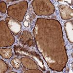 FAM160A1 Antibody in Immunohistochemistry (IHC)