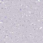 FAM160A1 Antibody in Immunohistochemistry (IHC)