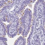 CCDC37 Antibody in Immunohistochemistry (IHC)