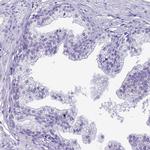 CCDC37 Antibody in Immunohistochemistry (IHC)