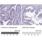 CCDC37 Antibody