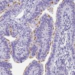 CCDC37 Polyclonal Antibody