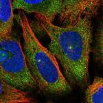 RFPL4A Polyclonal Antibody