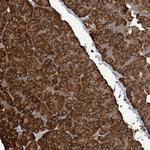 RFPL4A Antibody in Immunohistochemistry (Paraffin) (IHC (P))