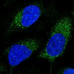 SLX4IP Polyclonal Antibody