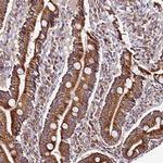 SLX4IP Antibody in Immunohistochemistry (IHC)