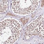 SLX4IP Antibody in Immunohistochemistry (IHC)