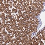 SLX4IP Antibody in Immunohistochemistry (IHC)