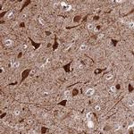SLX4IP Antibody in Immunohistochemistry (IHC)