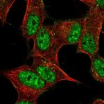 PRRT4 Polyclonal Antibody