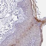 LCE6A Polyclonal Antibody