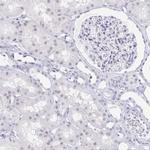 LCE6A Antibody in Immunohistochemistry (IHC)