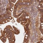 DDX19B Antibody in Immunohistochemistry (Paraffin) (IHC (P))