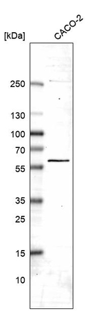 DDX19B Antibody in Western Blot (WB)