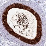 DEFB132 Polyclonal Antibody