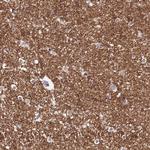 NALP11 Antibody in Immunohistochemistry (Paraffin) (IHC (P))