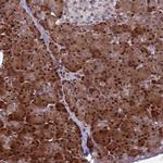 WBP11 Antibody in Immunohistochemistry (Paraffin) (IHC (P))