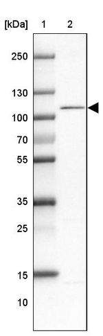 WBP11 Antibody in Western Blot (WB)