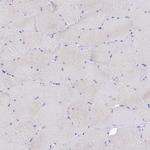 Oncomodulin Antibody in Immunohistochemistry (Paraffin) (IHC (P))