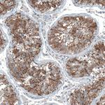 Oncomodulin Antibody in Immunohistochemistry (Paraffin) (IHC (P))