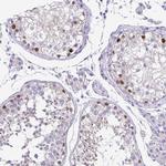 LUZP4 Antibody in Immunohistochemistry (IHC)