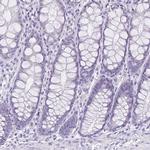 LUZP4 Antibody in Immunohistochemistry (IHC)