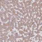 DPH5 Polyclonal Antibody