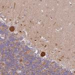 RPAP2 Antibody in Immunohistochemistry (Paraffin) (IHC (P))